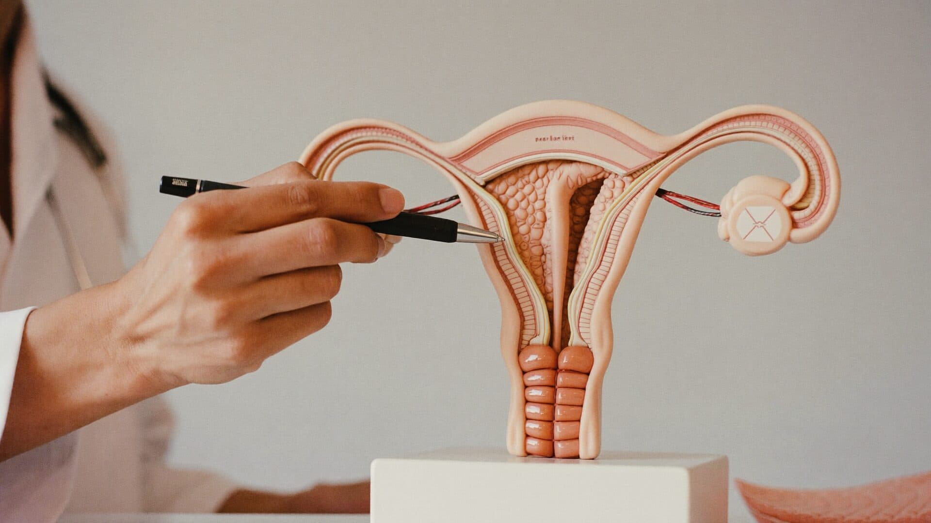 Çikolata Kisti (Endometriozis) Tedavisi