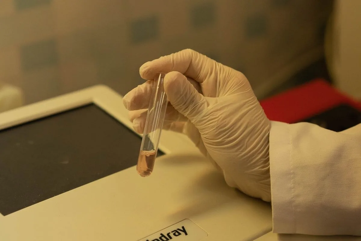 Anormal Uterin Kanama Nedir?