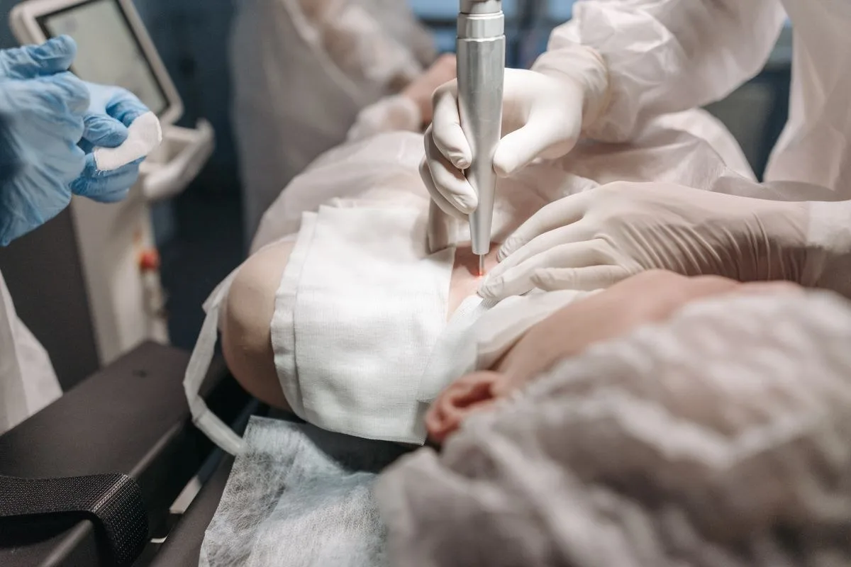 Lazerle Genital Siğil Tedavisi Nedir?
