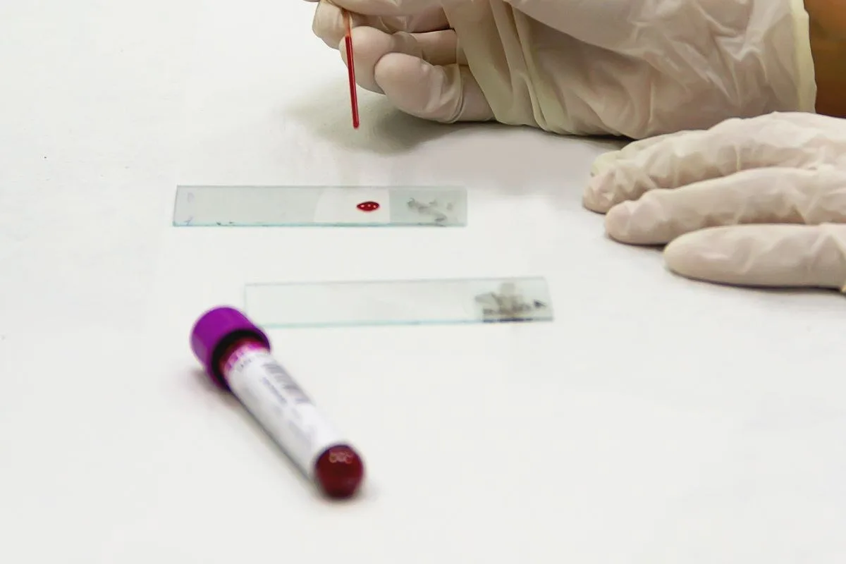 Genital PRP Riskler ve Olası Yan Etkiler