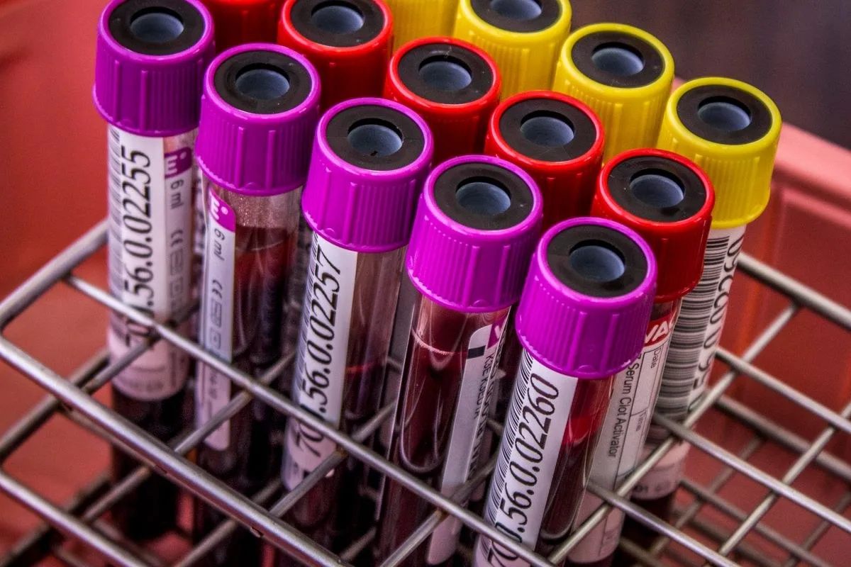 Samsun'da HPV testi yaptırırken dikkat edilecek kalite standartları